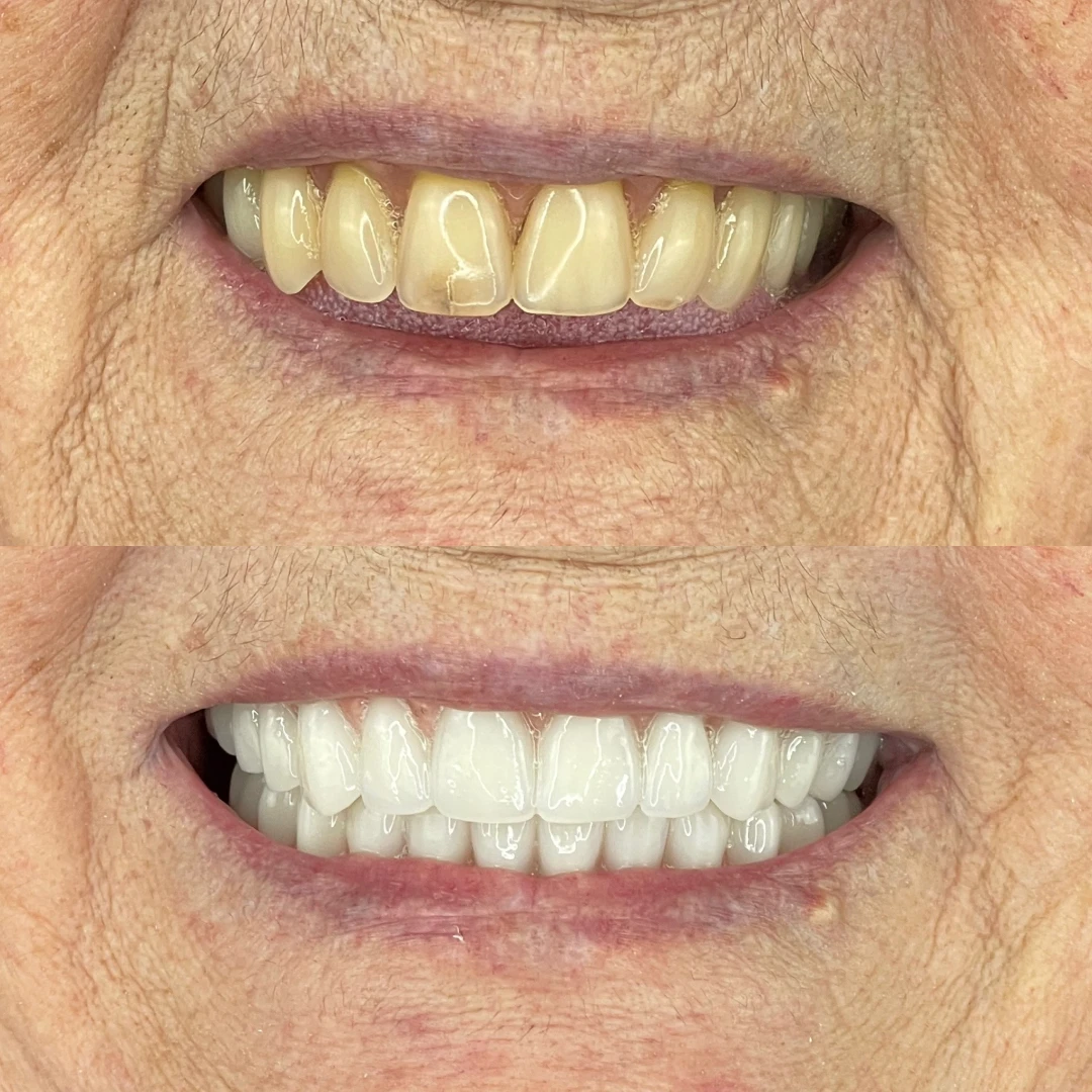 04220e52_e237_4073_b2ea_67de24ab0e3e_1x