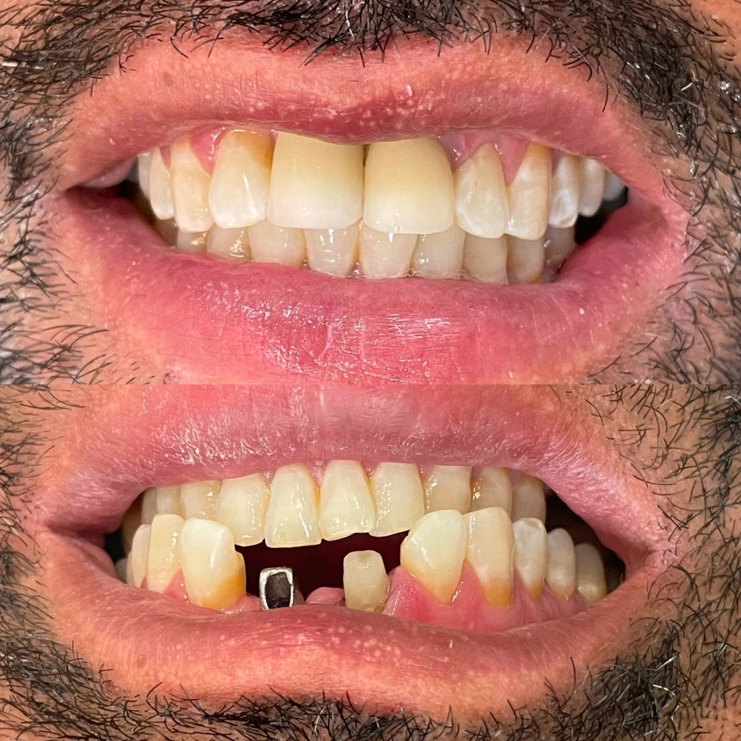 118dec0d_49cc_4fda_ac29_e9e21926dda9_1x