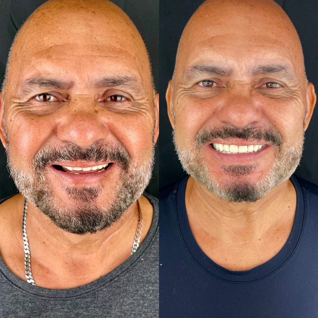 237b2e6b_b208_4abe_8115_a1659ad82868_1x