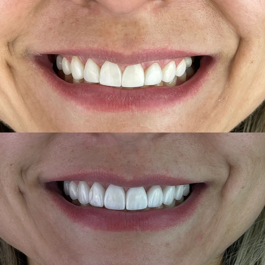 3a61f819_973f_482e_ad5f_67c2b998f6b1_1__1x