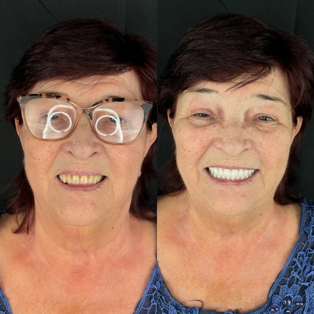 5bcfff71_08f2_4fdf_bb6a_5a982a11c8a5_1x