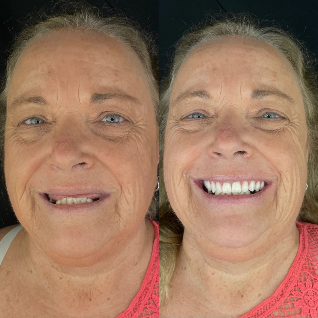 7436d3bd_a4d0_456f_9def_31e1e963216f_1__1x